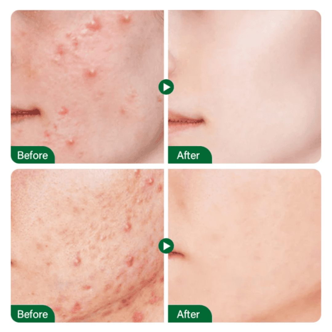 Teashell Niacinamide Serum skin results